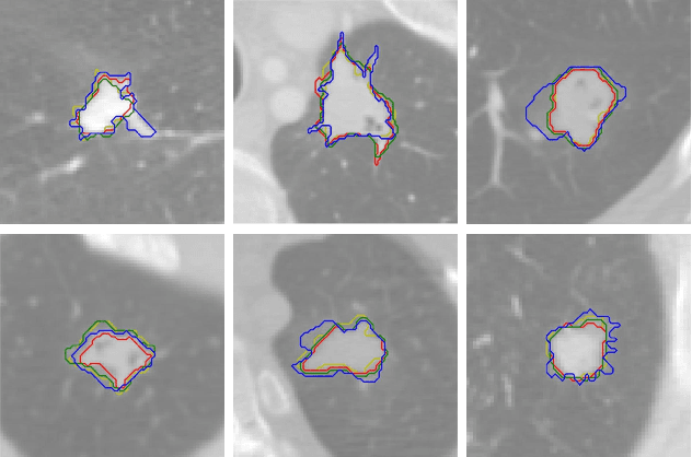 Figure 3 for Confidence Contours: Uncertainty-Aware Annotation for Medical Semantic Segmentation