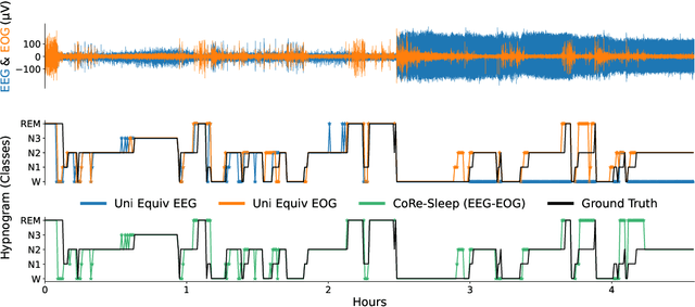 Figure 3 for CoRe-Sleep: A Multimodal Fusion Framework for Time Series Robust to Imperfect Modalities