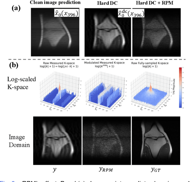 Figure 2 for U$^2$MRPD: Unsupervised undersampled MRI reconstruction by prompting a large latent diffusion model