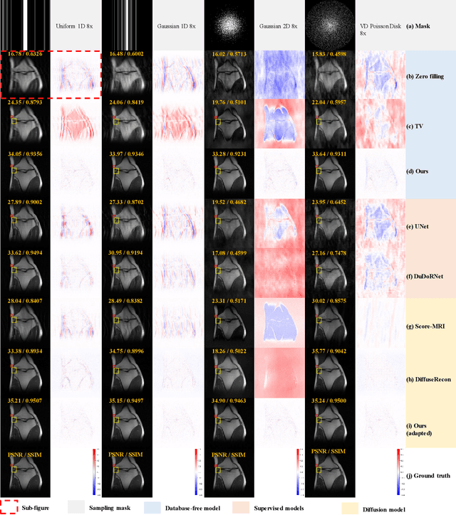 Figure 3 for U$^2$MRPD: Unsupervised undersampled MRI reconstruction by prompting a large latent diffusion model