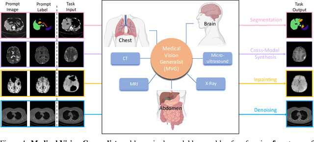 Figure 1 for Medical Vision Generalist: Unifying Medical Imaging Tasks in Context