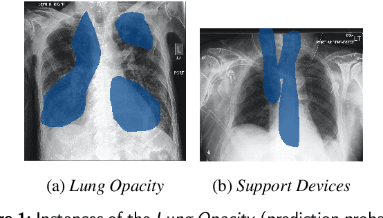 Figure 2 for SHAMSUL: Simultaneous Heatmap-Analysis to investigate Medical Significance Utilizing Local interpretability methods