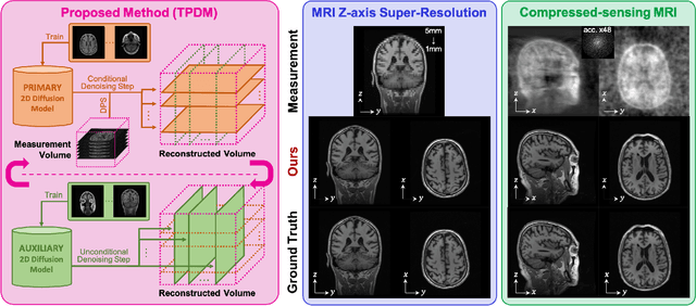 Figure 1 for Improving 3D Imaging with Pre-Trained Perpendicular 2D Diffusion Models