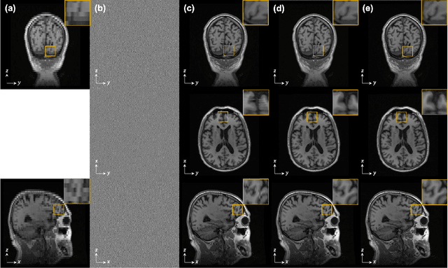 Figure 3 for Improving 3D Imaging with Pre-Trained Perpendicular 2D Diffusion Models