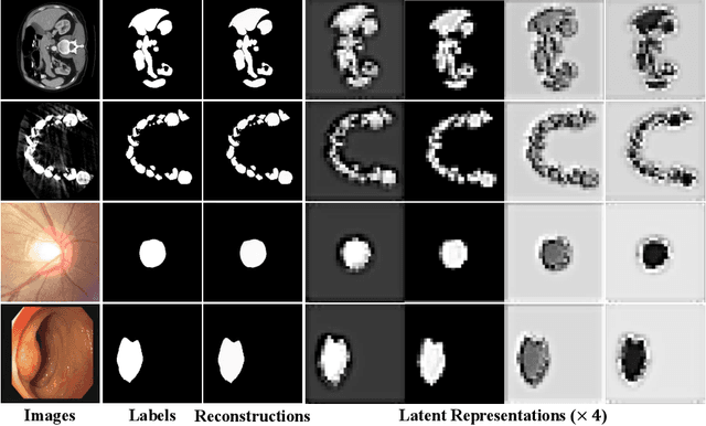 Figure 3 for Stable Diffusion Segmentation for Biomedical Images with Single-step Reverse Process