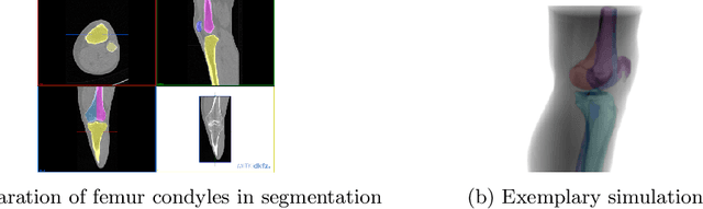 Figure 2 for Shape-based pose estimation for automatic standard views of the knee