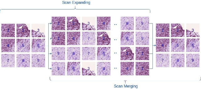 Figure 3 for Classification of Gleason Grading in Prostate Cancer Histopathology Images Using Deep Learning Techniques: YOLO, Vision Transformers, and Vision Mamba