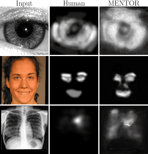 Figure 3 for MENTOR: Human Perception-Guided Pretraining for Iris Presentation Detection