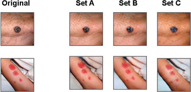 Figure 4 for Are generative models fair? A study of racial bias in dermatological image generation