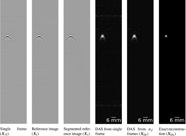 Figure 3 for Single Frame Laser Diode Photoacoustic Imaging: Denoising and Reconstruction