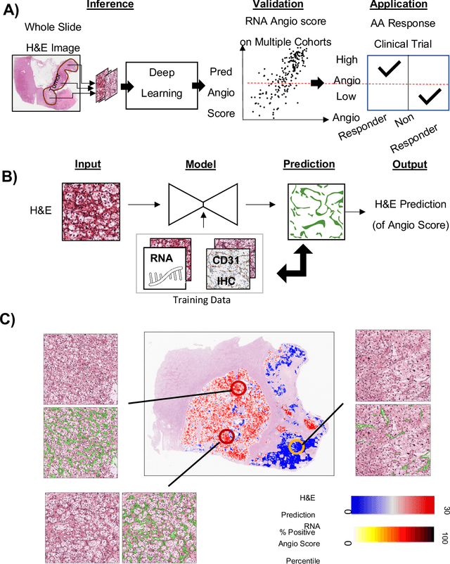 Figure 1 for Histopathology Based AI Model Predicts Anti-Angiogenic Therapy Response in Renal Cancer Clinical Trial