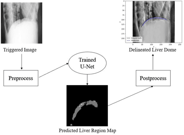 Figure 1 for Deep Learning-Based Automatic Delineation of Liver Domes in kV Triggered Images for Online Breath-hold Reproducibility Verification of Liver Stereotactic Body Radiation Therapy