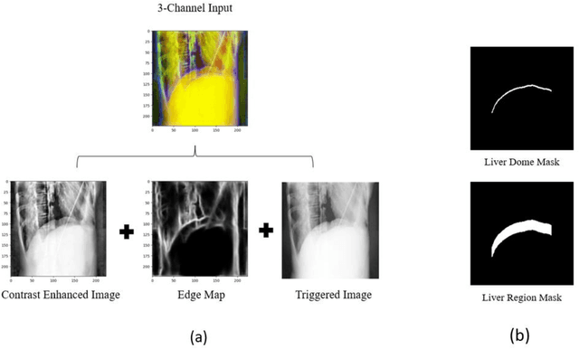 Figure 3 for Deep Learning-Based Automatic Delineation of Liver Domes in kV Triggered Images for Online Breath-hold Reproducibility Verification of Liver Stereotactic Body Radiation Therapy