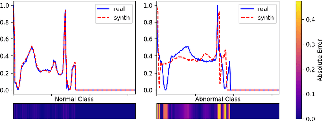 Figure 1 for Adversarial Anomaly Detection using Gaussian Priors and Nonlinear Anomaly Scores