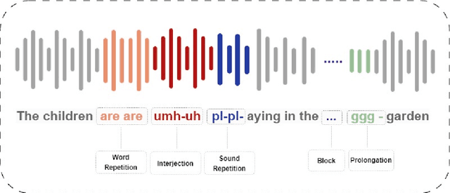 Figure 1 for Optimizing Multi-Stuttered Speech Classification: Leveraging Whisper's Encoder for Efficient Parameter Reduction in Automated Assessment