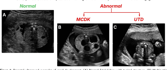 Figure 1 for Self-Supervised Ultrasound Representation Learning for Renal Anomaly Prediction in Prenatal Imaging