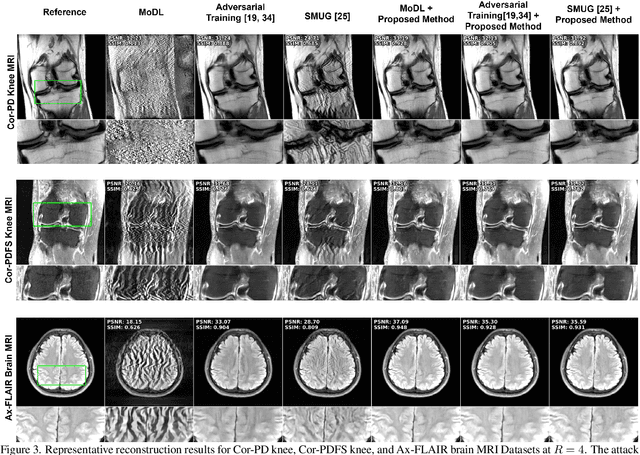 Figure 4 for Detecting and Mitigating Adversarial Attacks on Deep Learning-Based MRI Reconstruction Without Any Retraining