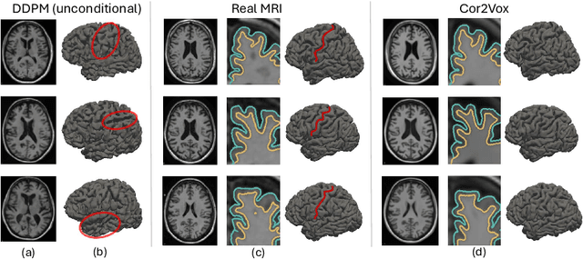 Figure 1 for 3D Shape-to-Image Brownian Bridge Diffusion for Brain MRI Synthesis from Cortical Surfaces