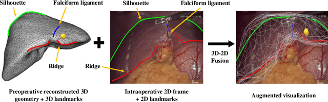 Figure 1 for Depth-Driven Geometric Prompt Learning for Laparoscopic Liver Landmark Detection