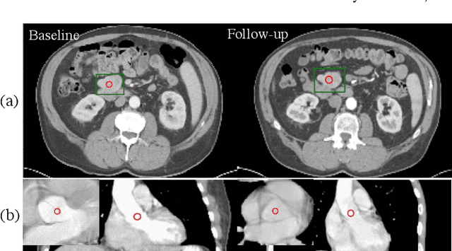 Figure 1 for SAMv2: A Unified Framework for Learning Appearance, Semantic and Cross-Modality Anatomical Embeddings