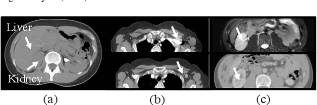 Figure 3 for SAMv2: A Unified Framework for Learning Appearance, Semantic and Cross-Modality Anatomical Embeddings