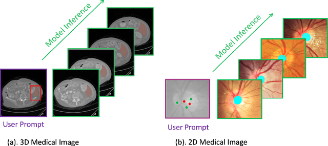 Figure 1 for Medical SAM 2: Segment medical images as video via Segment Anything Model 2