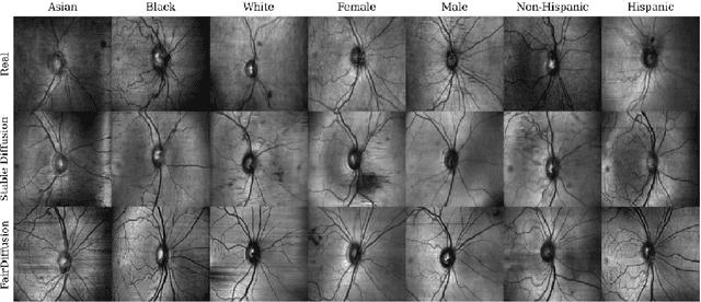 Figure 2 for FairDiffusion: Enhancing Equity in Latent Diffusion Models via Fair Bayesian Perturbation