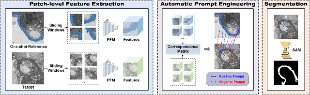 Figure 1 for Feature-prompting GBMSeg: One-Shot Reference Guided Training-Free Prompt Engineering for Glomerular Basement Membrane Segmentation