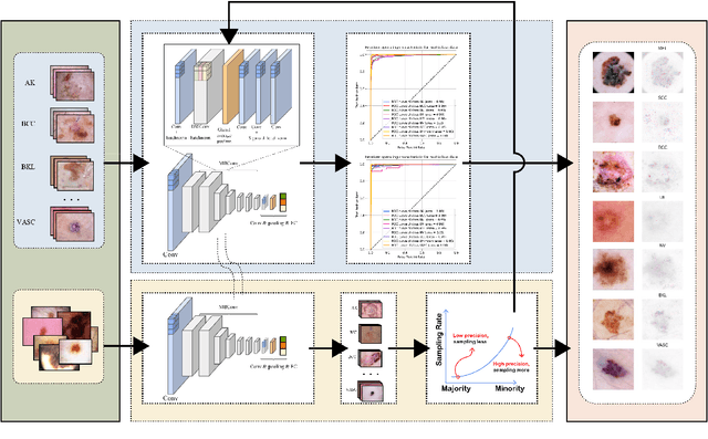 Figure 3 for An interpretable imbalanced semi-supervised deep learning framework for improving differential diagnosis of skin diseases