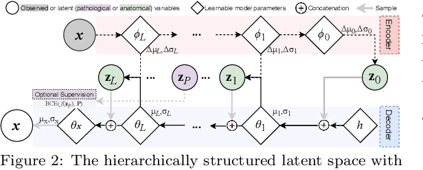 Figure 3 for Clinically Plausible Pathology-Anatomy Disentanglement in Patient Brain MRI with Structured Variational Priors