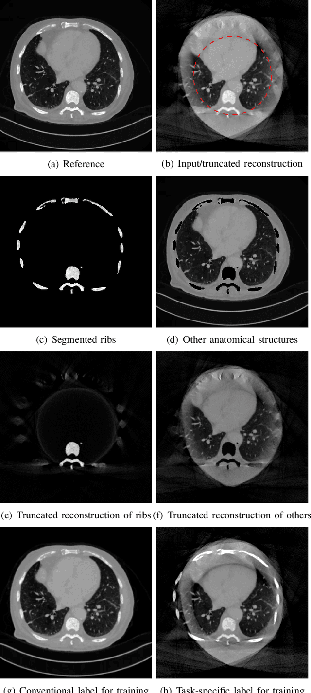 Figure 1 for Task-Specific Data Preparation for Deep Learning to Reconstruct Structures of Interest from Severely Truncated CBCT Data