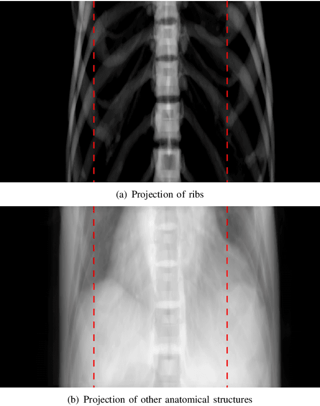 Figure 2 for Task-Specific Data Preparation for Deep Learning to Reconstruct Structures of Interest from Severely Truncated CBCT Data