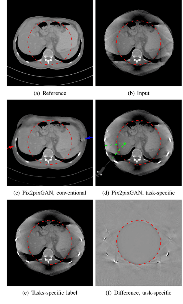 Figure 3 for Task-Specific Data Preparation for Deep Learning to Reconstruct Structures of Interest from Severely Truncated CBCT Data