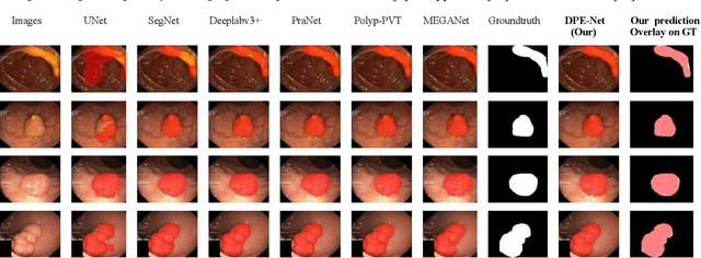 Figure 3 for DPE-Net: Dual-Parallel Encoder Based Network for Semantic Segmentation of Polyps