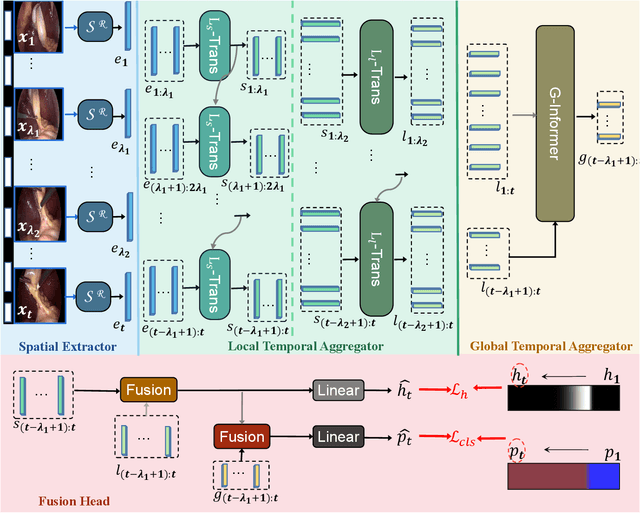 Figure 1 for LoViT: Long Video Transformer for Surgical Phase Recognition