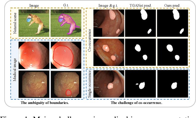 Figure 1 for ConDSeg: A General Medical Image Segmentation Framework via Contrast-Driven Feature Enhancement