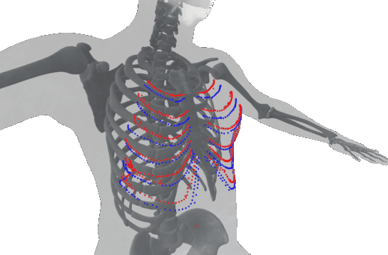 Figure 3 for An Anatomy-Aware Shared Control Approach for Assisted Teleoperation of Lung Ultrasound Examinations