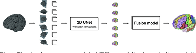 Figure 1 for Fully Automated Tumor Segmentation for Brain MRI data using Multiplanner UNet