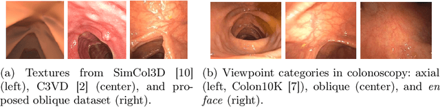 Figure 1 for Structure-preserving Image Translation for Depth Estimation in Colonoscopy Video