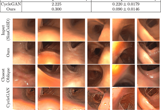 Figure 4 for Structure-preserving Image Translation for Depth Estimation in Colonoscopy Video