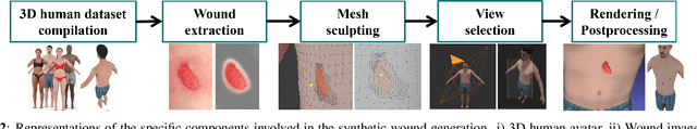 Figure 3 for Syn3DWound: A Synthetic Dataset for 3D Wound Bed Analysis