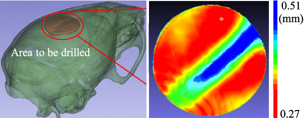 Figure 1 for A Cranial-Feature-Based Registration Scheme for Robotic Micromanipulation Using a Microscopic Stereo Camera System