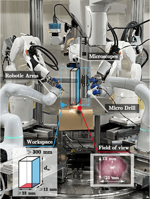 Figure 4 for A Cranial-Feature-Based Registration Scheme for Robotic Micromanipulation Using a Microscopic Stereo Camera System