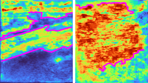Figure 4 for NeRF-US: Removing Ultrasound Imaging Artifacts from Neural Radiance Fields in the Wild