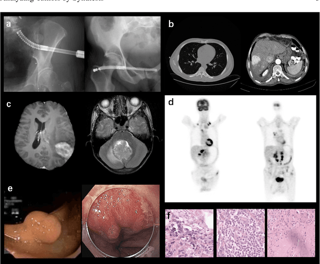 Figure 1 for Analyzing Tumors by Synthesis