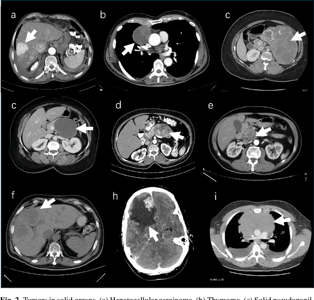 Figure 3 for Analyzing Tumors by Synthesis