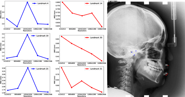 Figure 1 for Multi-Resolution Fusion for Fully Automatic Cephalometric Landmark Detection