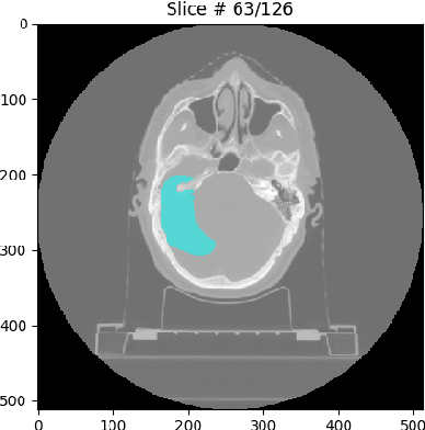 Figure 4 for Informing selection of performance metrics for medical image segmentation evaluation using configurable synthetic errors