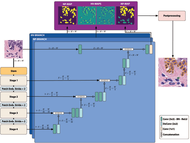 Figure 2 for NuLite -- Lightweight and Fast Model for Nuclei Instance Segmentation and Classification