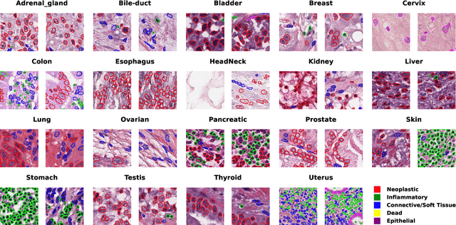 Figure 3 for NuLite -- Lightweight and Fast Model for Nuclei Instance Segmentation and Classification